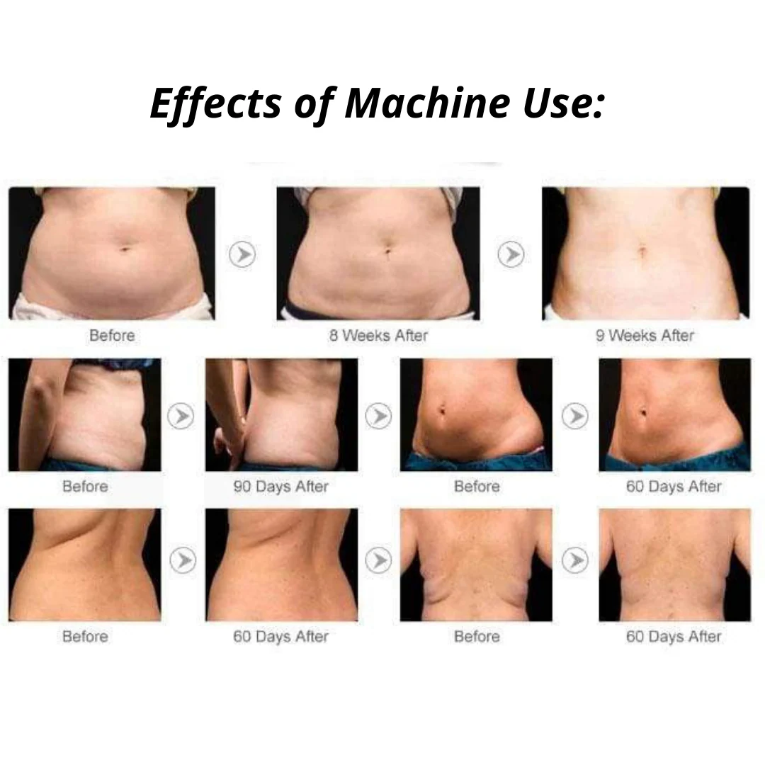 Adonis™ 9 in 1 Cavitation Machine for Toning & Slimming - Image 9