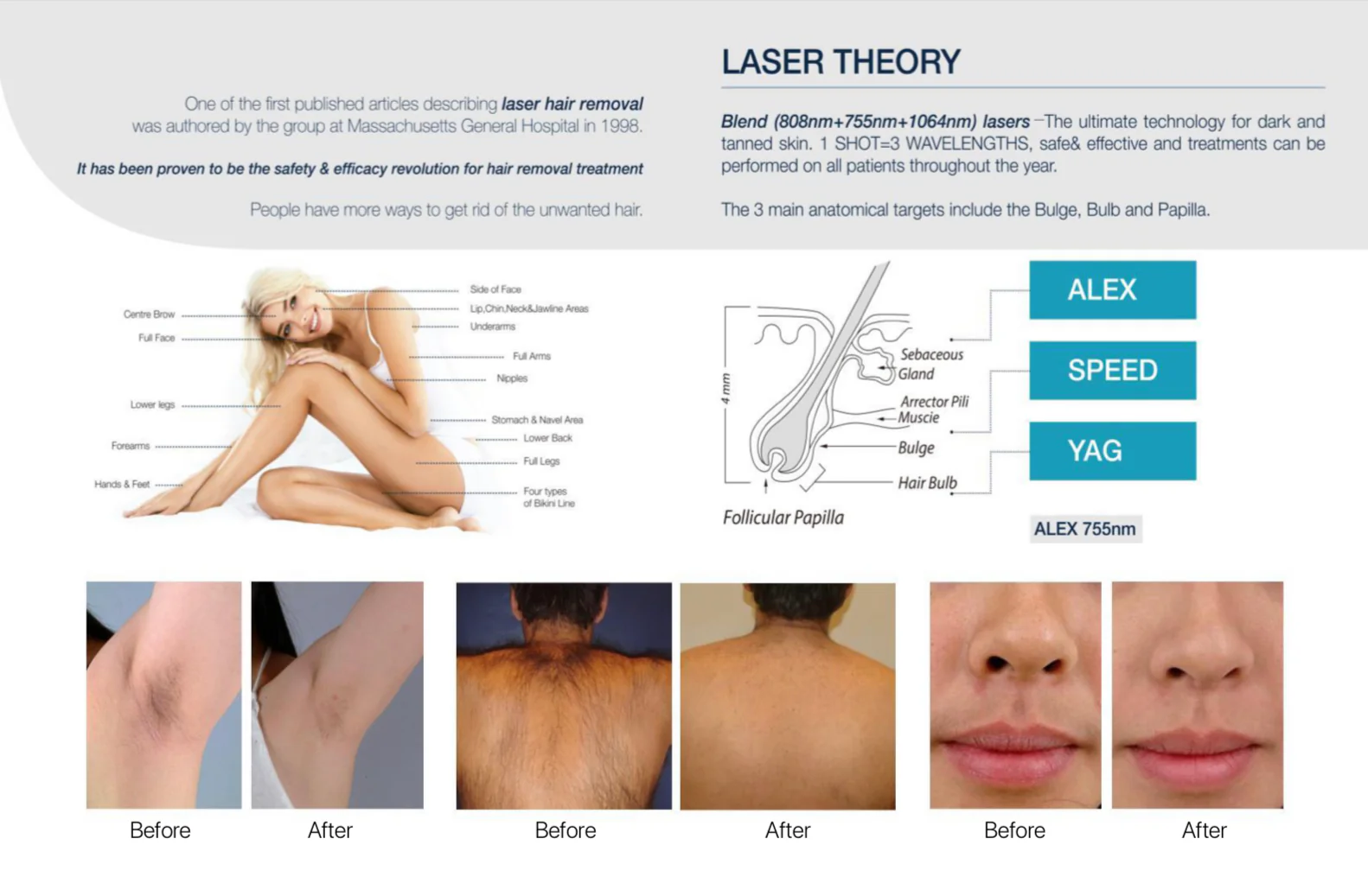 Elite Smooth™ Hair Removal Diode Laser Portable - Image 8