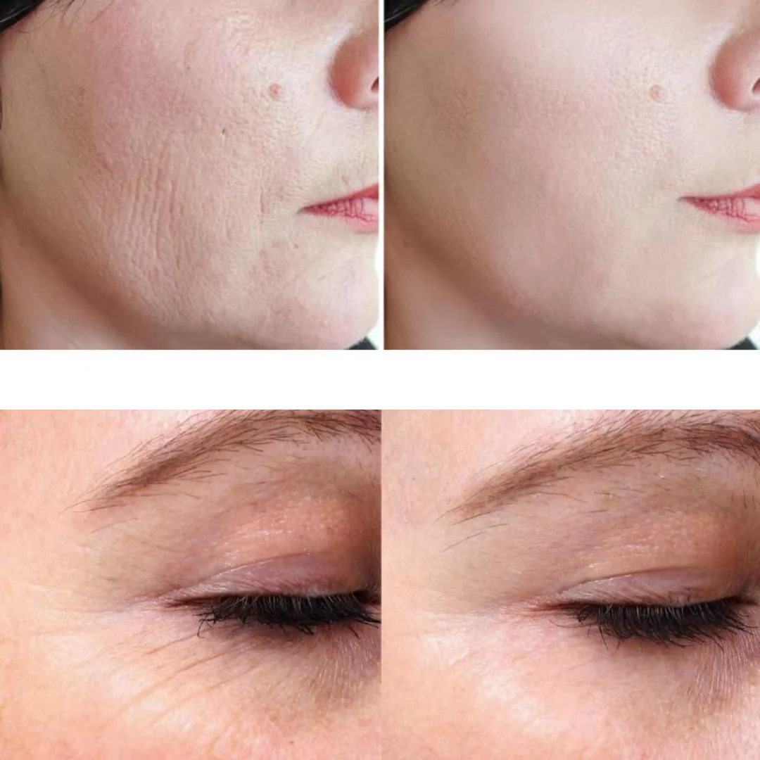 Eris® Lipo Cavitation Machine 9 in 1 Professional - Image 17