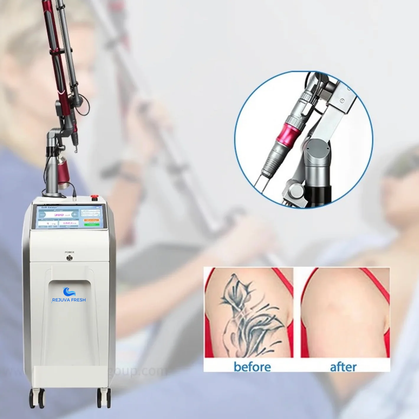 Luna Ink Pro Nanosecond Laser Tattoo Removal Machine - Image 10