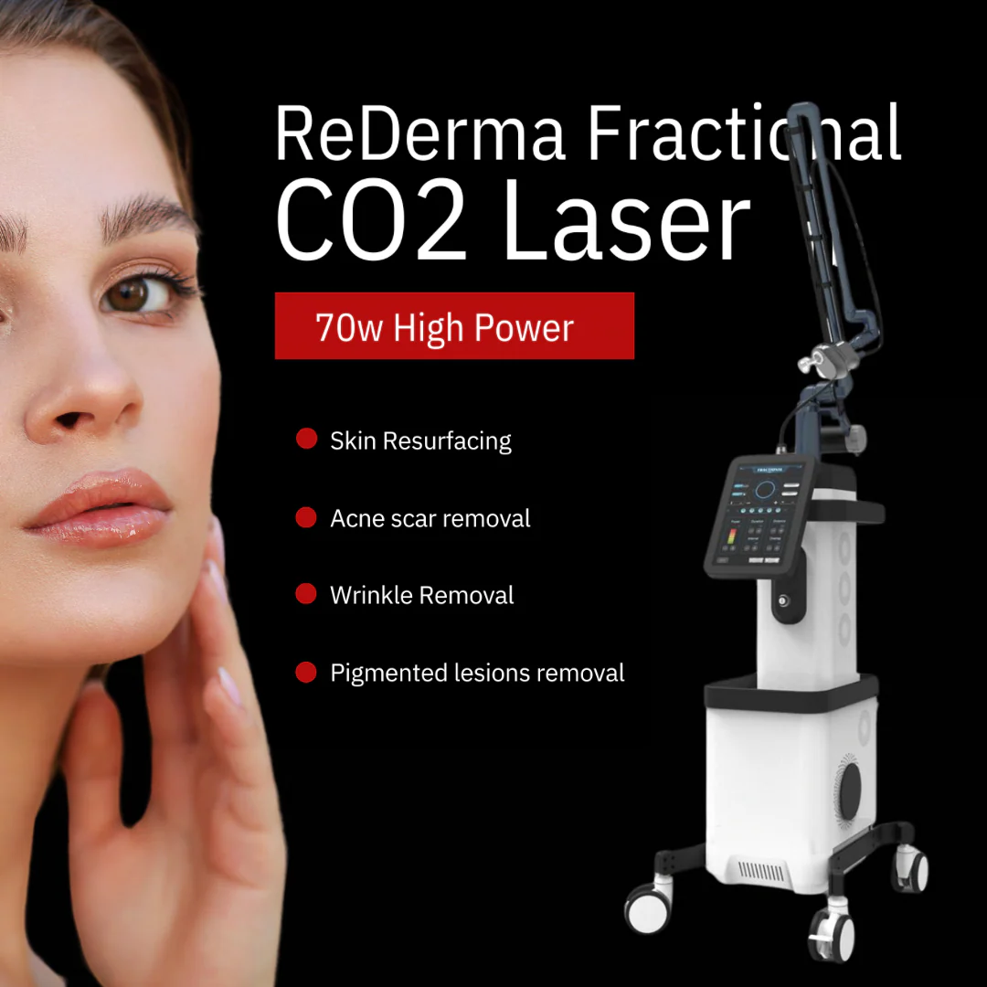 ReDerma™ Fractional CO2 Laser - Image 3