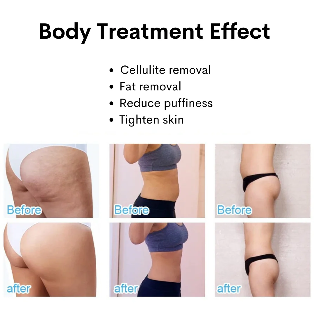 SlimSphere Roller Therapy EMS Body Sculpt Machine - Image 10