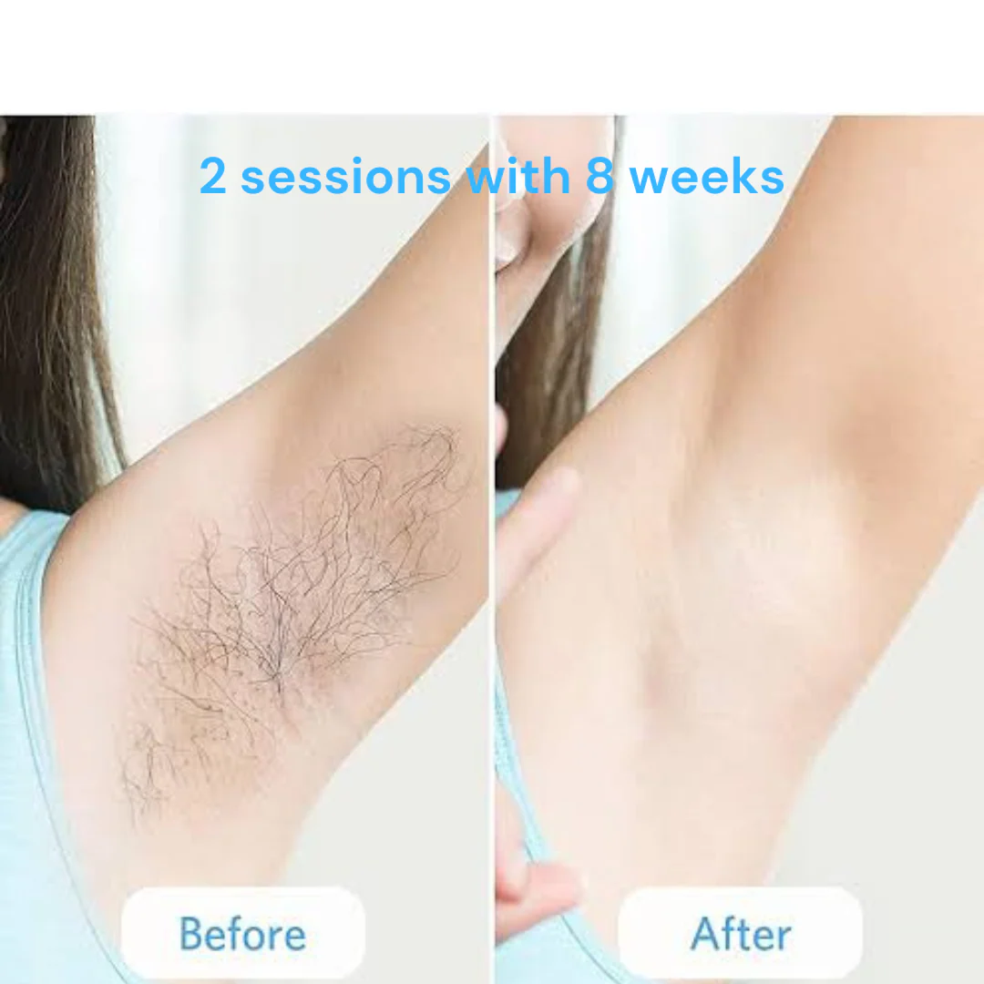 Smooth Goddess™ 808nm Diode Laser + Skin Rejuvenation - Image 6