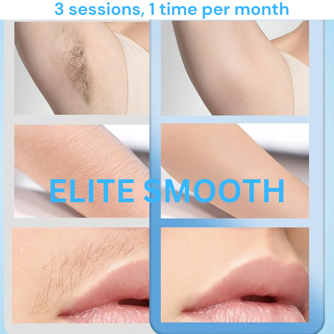 Smooth Goddess™ 808nm Diode Laser + Skin Rejuvenation - Image 7